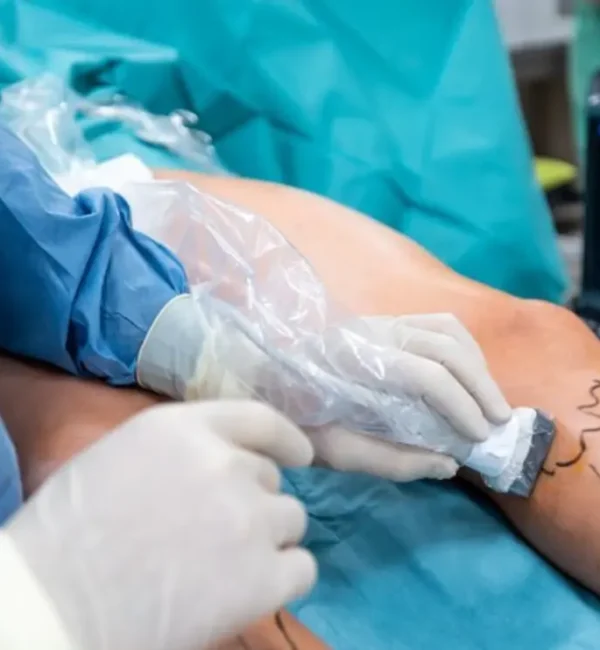 The Future of Varicose Vein Treatment: How Advanced Techniques Are Revolutionizing Care