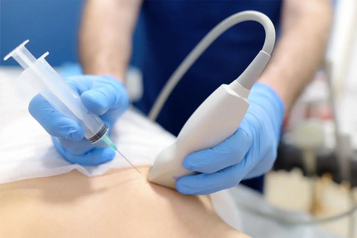 Image-Guided Biopsy