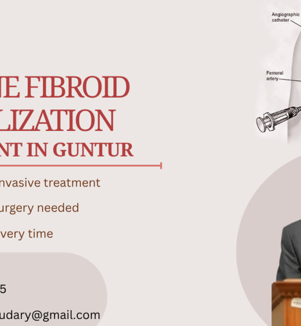 Uterine Fibroid Embolization (UFE)