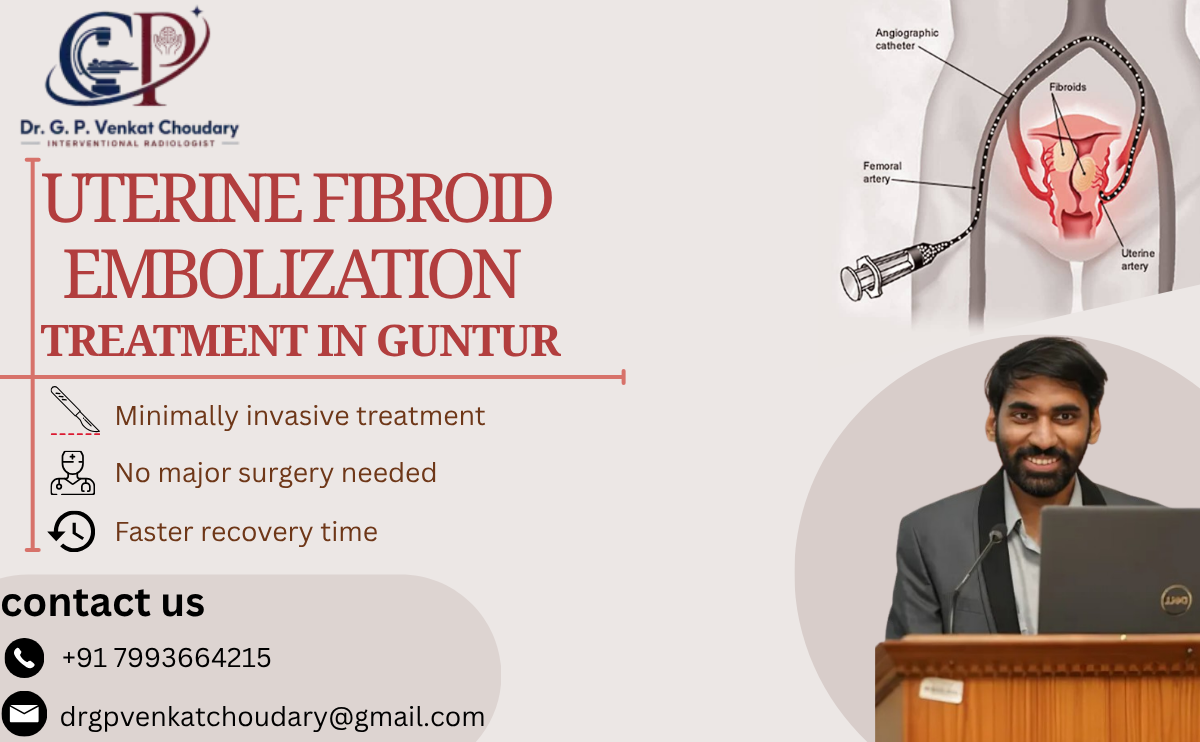 Uterine Fibroid Embolization (UFE)