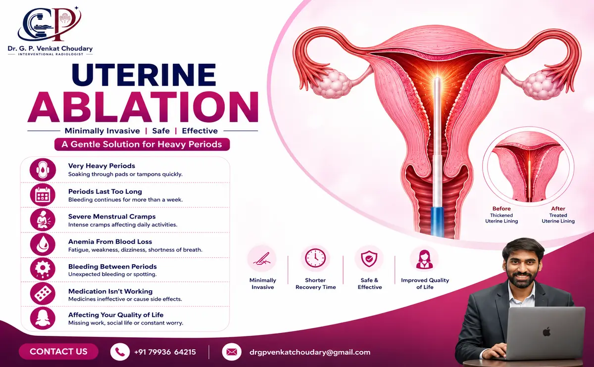 7 Signs You May Need Uterine Ablation