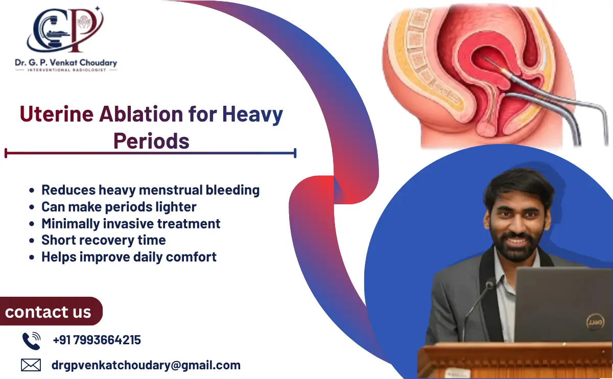 Uterine Ablation for Heavy Periods