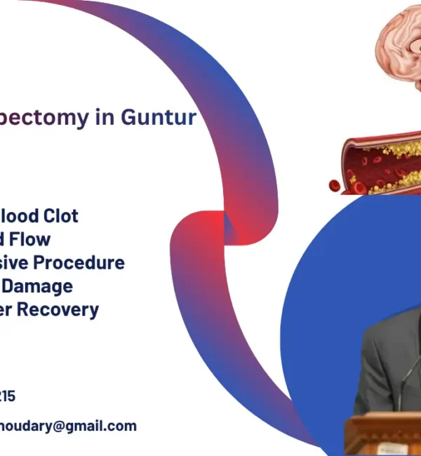 Stroke Thrombectomy: Procedure & Recovery