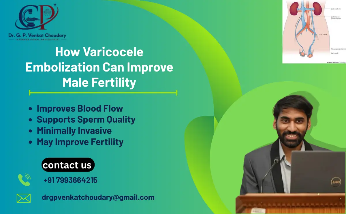 varicocele embolization treatment