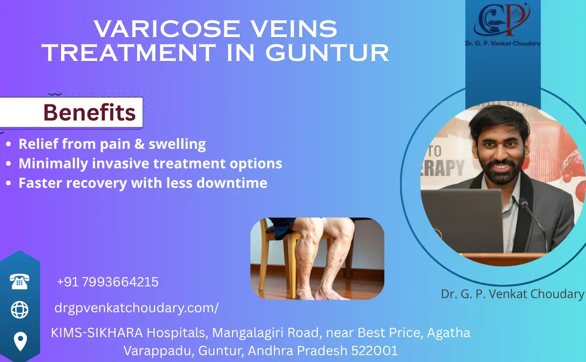 Varicose Veins Treatment in Guntur