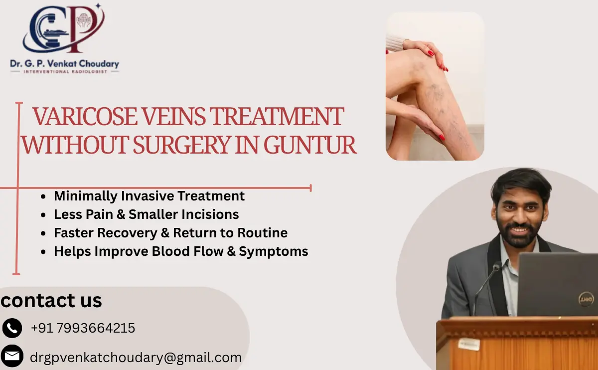Varicose Veins Treatment Without Surgery in Guntur